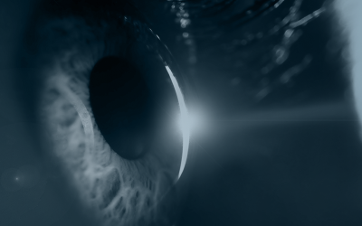 O que é Glaucoma e seus principais sintomas